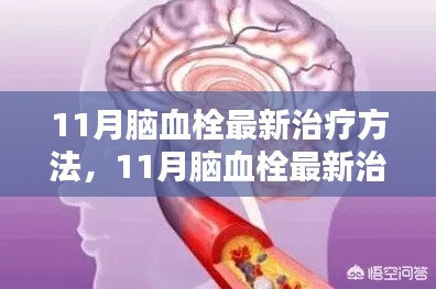 11月脑血栓最新治疗方法详解与深度评测