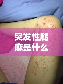 突发性腿麻是什么情况呢，突然间腿麻是什么情况 